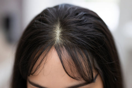 Lace Front vs Silk Top Sheitels: Which Provides the Most Realistic Hairline for Orthodox Women?