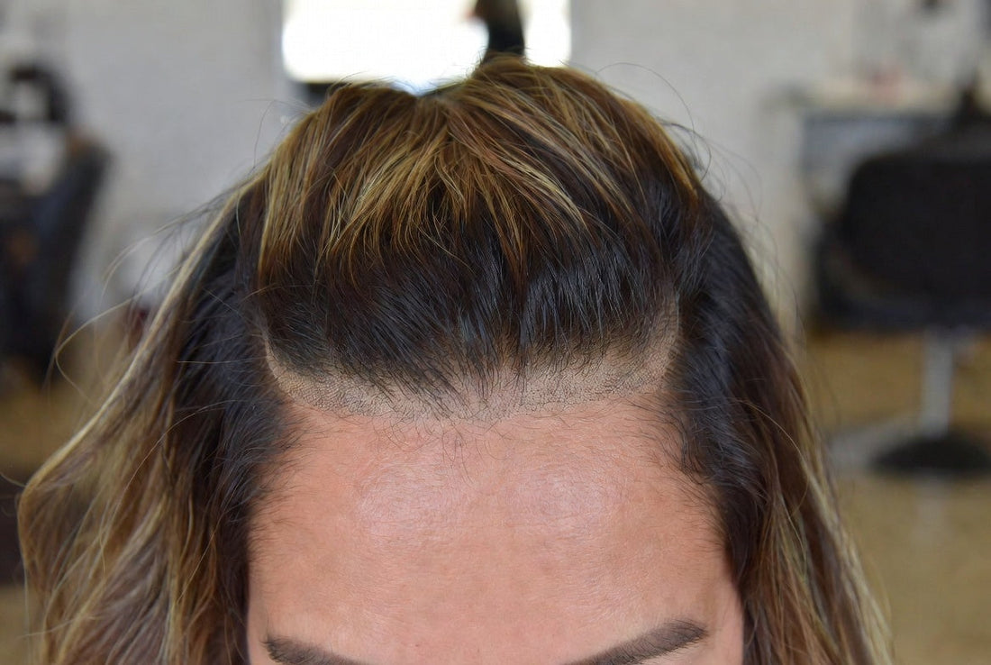 Custom Color Toppers vs DIY Dyeing: Why Professional Toning Wins for Crown Pieces