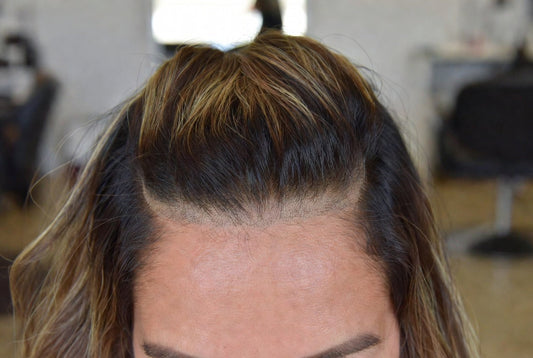 Custom Color Toppers vs DIY Dyeing: Why Professional Toning Wins for Crown Pieces