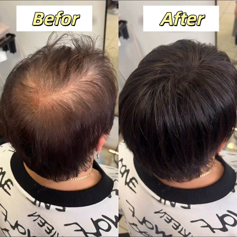 2026 New Short Hair Topper for Thinning Hair – Natural Look, Easy Clip-In