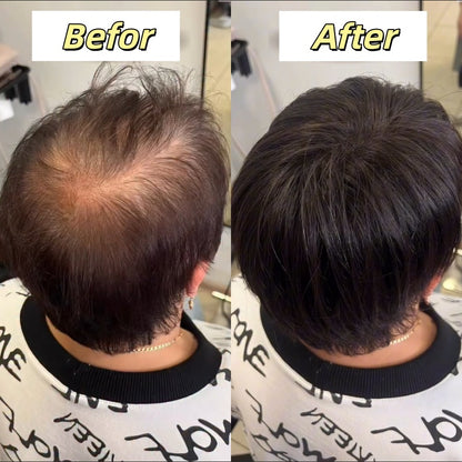 2026 New Short Hair Topper for Thinning Hair – Natural Look, Easy Clip-In