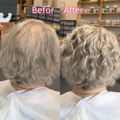 Hot Sale Fashion Curly Hair Toppers for Women with Thinning Hair-Cover Grays, Boost Volume