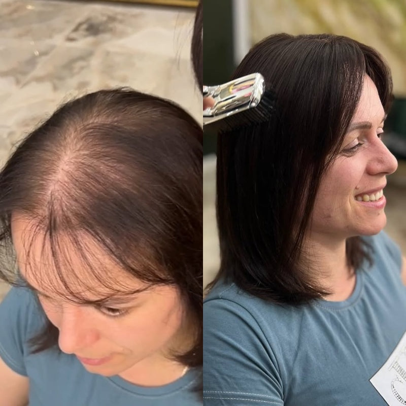 Straight Hair Topper for Crown Thinning – Natural Coverage at the Crown - VIVACROWN
