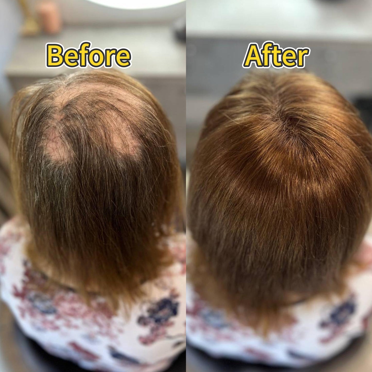 Straight Bob Hair Topper with Bangs – Instant Crown Volume & Coverage for Thinning Hair