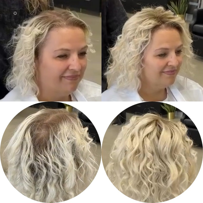 Premium Curly Hair Toppers for Women with Thinning Hair