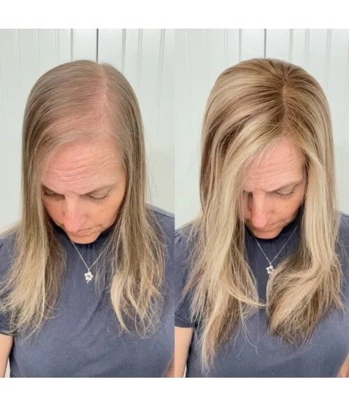 2025年新登場、薄毛の女性のための軽量・通気性ストレートヘアトッパー
