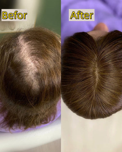 Straight Hair Topper for Crown Thinning – Natural Coverage at the Crown - VIVACROWN