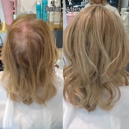 2025 New Lightweight&Breathable Wavy Hair Topper For Women With Thinning Hair