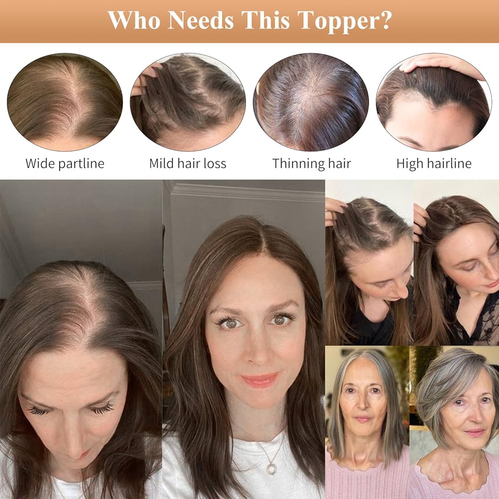 Straight Hair Topper for Crown Thinning – Natural Coverage at the Crown - VIVACROWN