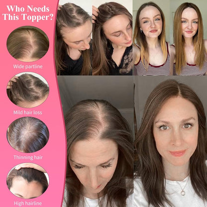 薄毛の女性のためのラージレースベースヘアトッパー