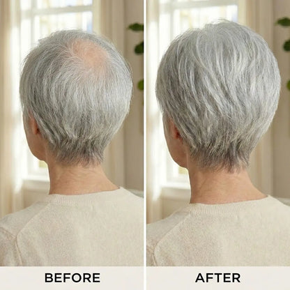 9*9cm Base Silver Full Hand tied Mono Base 100% Virgin Remy Hair Topper - VIVACROWN