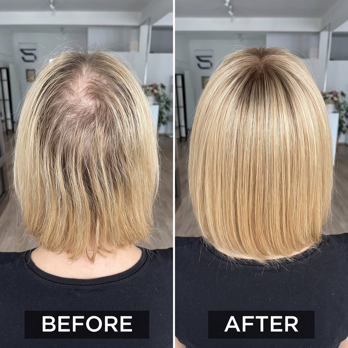 Hot Sale Straight Hair Topper With Bangs For  Women With Thinning Hair
