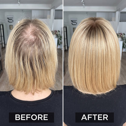 Hot Sale Straight Hair Topper With Bangs For  Women With Thinning Hair