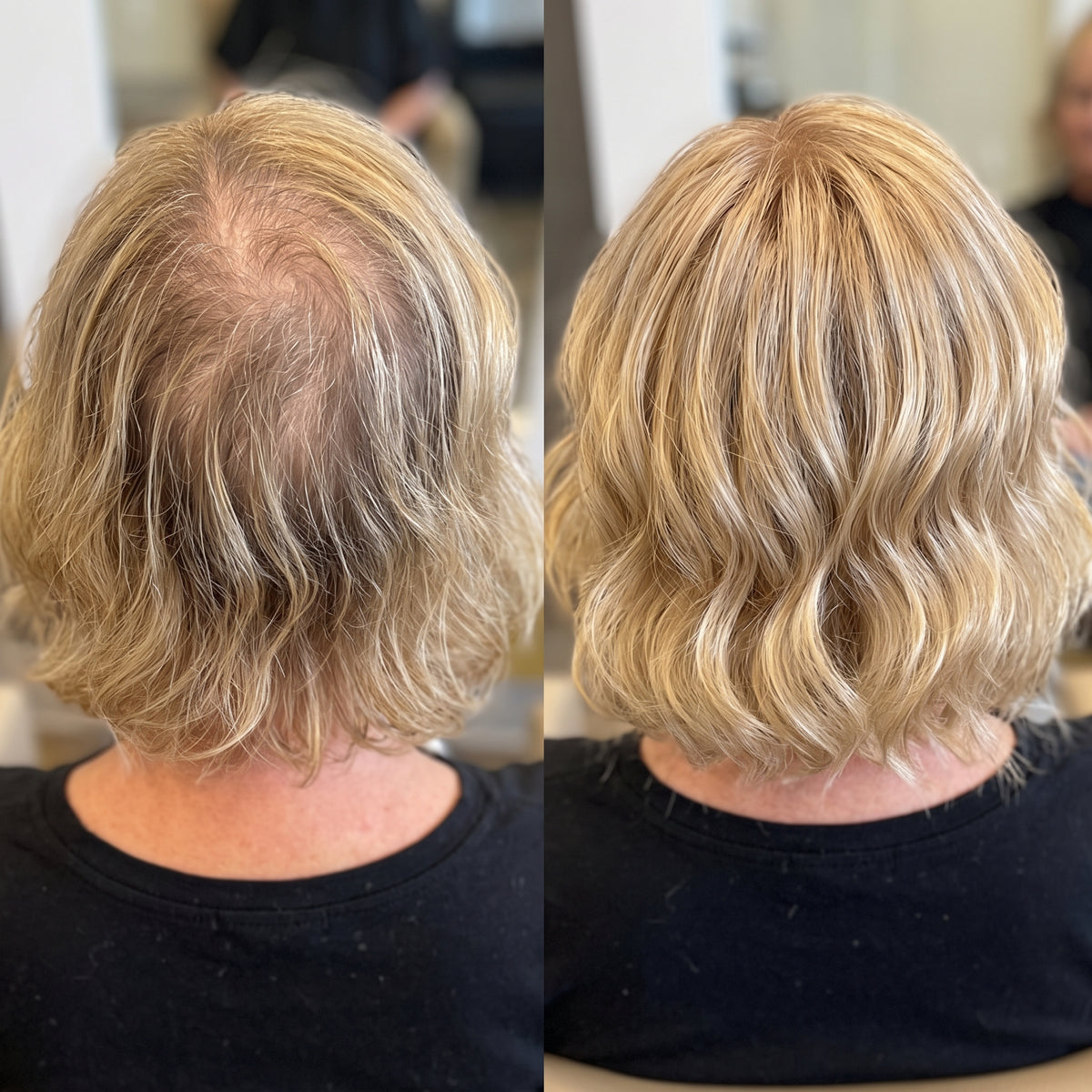 Natural Wavy Clip-In Hair Topper with Bangs | Full Crown Coverage for Thinning Hair