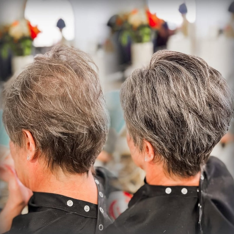 2025年 薄毛対策ショートヘア用トッパー