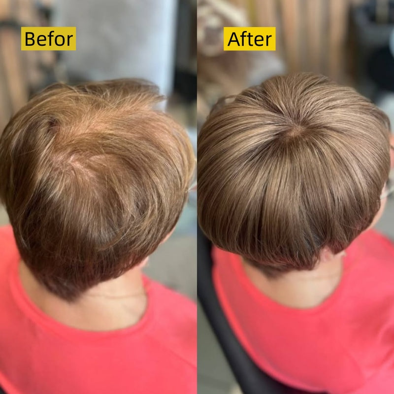 2026 New Short Hair Topper for Thinning Hair – Natural Look, Easy Clip-In