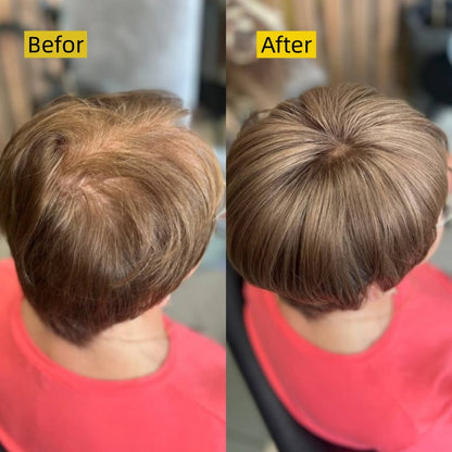 2026 New Short Hair Topper for Thinning Hair – Natural Look, Easy Clip-In