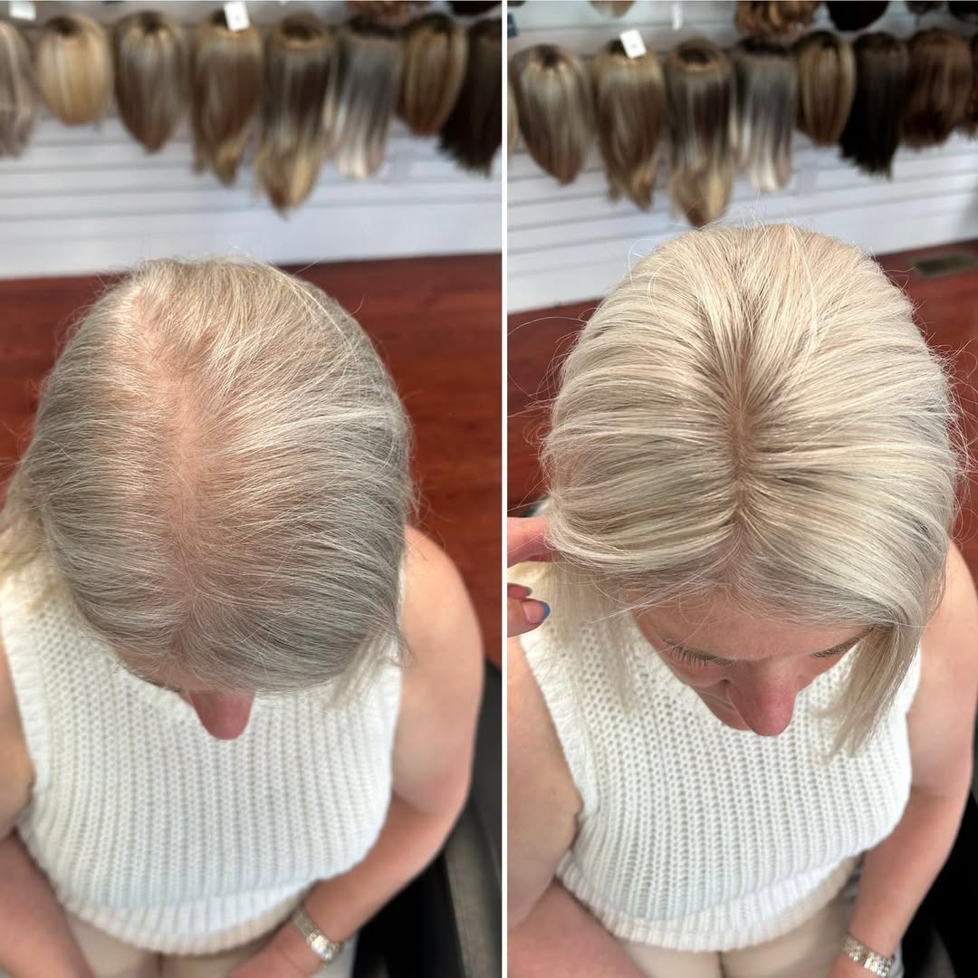 Straight Hair Topper for Crown Thinning – Natural Coverage at the Crown - VIVACROWN