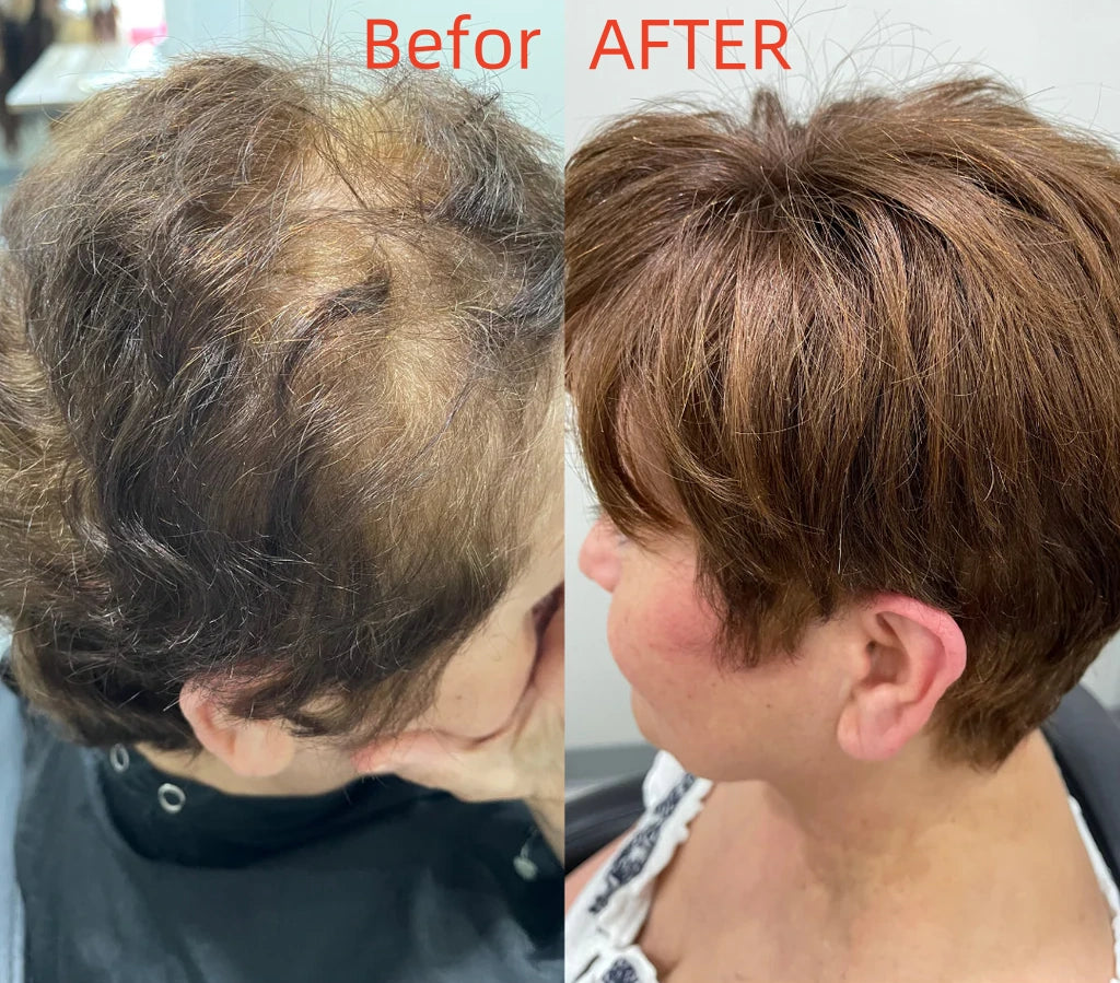Summer Breathable&comfortable Short Hair Topper For Thinning Hair