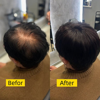 2026 New Short Hair Topper for Thinning Hair – Natural Look, Easy Clip-In