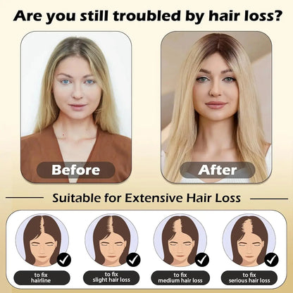 3"×5" Blonde Ombre Balayage Human Hair Topper for Women 我的商店