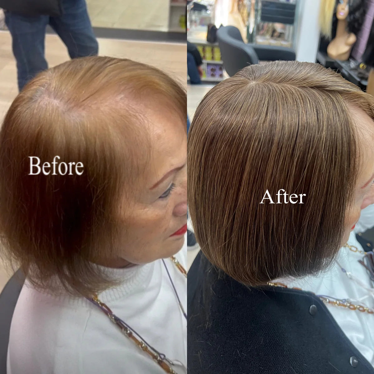 Straight Hair Topper for Crown Thinning – Natural Coverage at the Crown