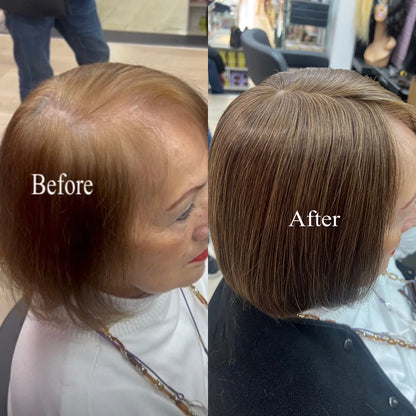 Straight Hair Topper for Crown Thinning – Natural Coverage at the Crown
