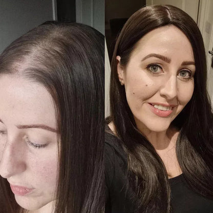 10*12cm Virgin Remy Human Hair Topper for Women VIVACROWN Hair Topper